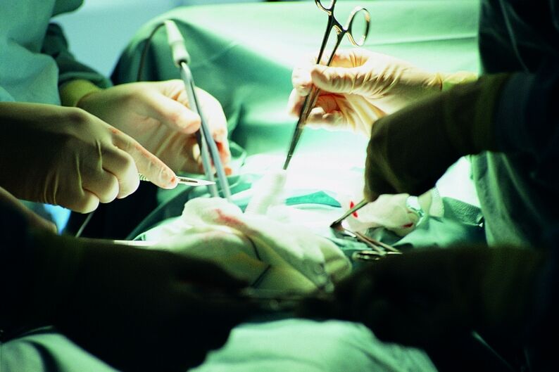 peenise paksuse kirurgiline suurendamine